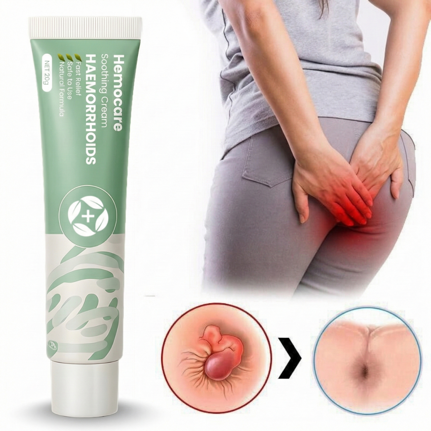 HemoCare™ Kräuter-Hämorrhoidencreme | Behandelt 99 % aller Hämorrhoiden bereits nach der ersten Anwendung!